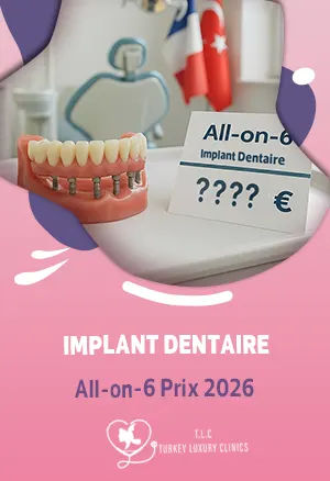 Implant Dentaire All-on-6 Prix 2026featured image