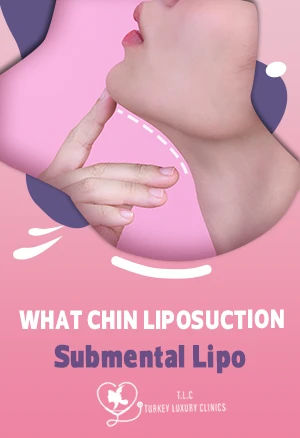 Chin Liposuction (Submental Lipo): Cost, Recovery & Results 2026