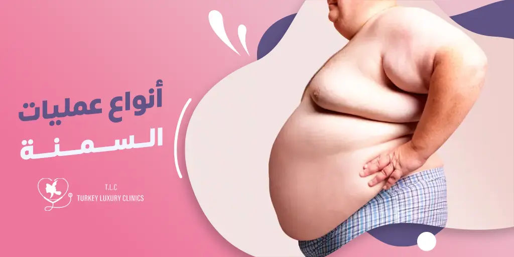 أنواع عمليات السمنة 