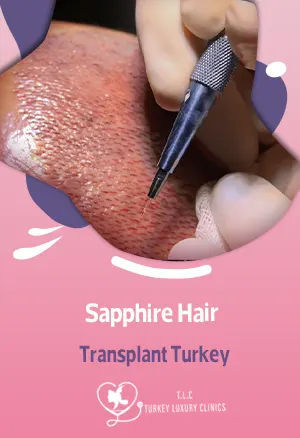 Trasplante Capilar Zafiro en Turquía: Cabello Denso a Precio Accesiblefeatured image