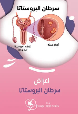 اعراض سرطان البروستاتا: علامات تستوجب الحذر! تعرف عليها