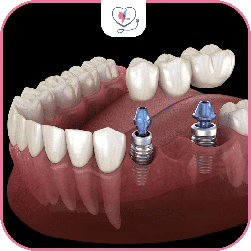 Boosted Confidence And Enhanced Quality Of Life