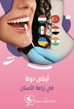 أرخص دولة في زراعة الأسنان: مقارنة بين جميع الدولfeatured image