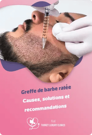 Greffe de barbe ratée : Causes, solutions et recommandations