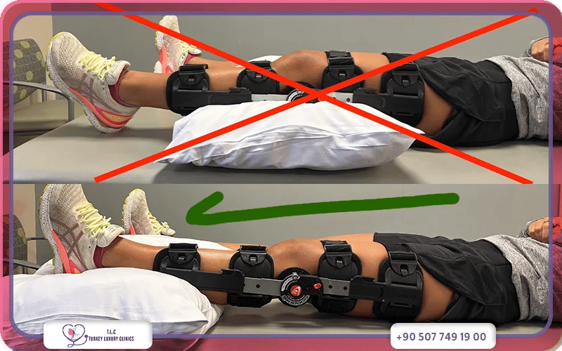 متى يمكن العودة إلى وضعيات النوم الطبيعية بعد عملية الرباط الصليبي؟