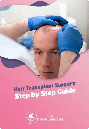 Hair Transplant Surgery: Step by Step Guide