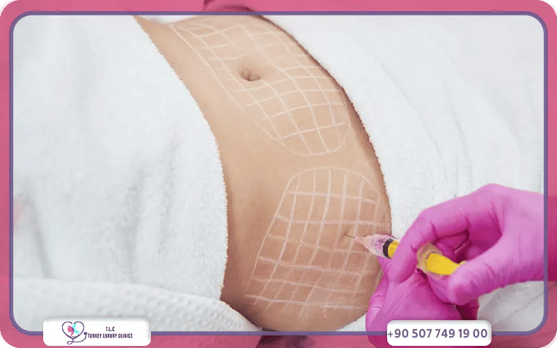 Fat Dissolving Injections Cost Comparison