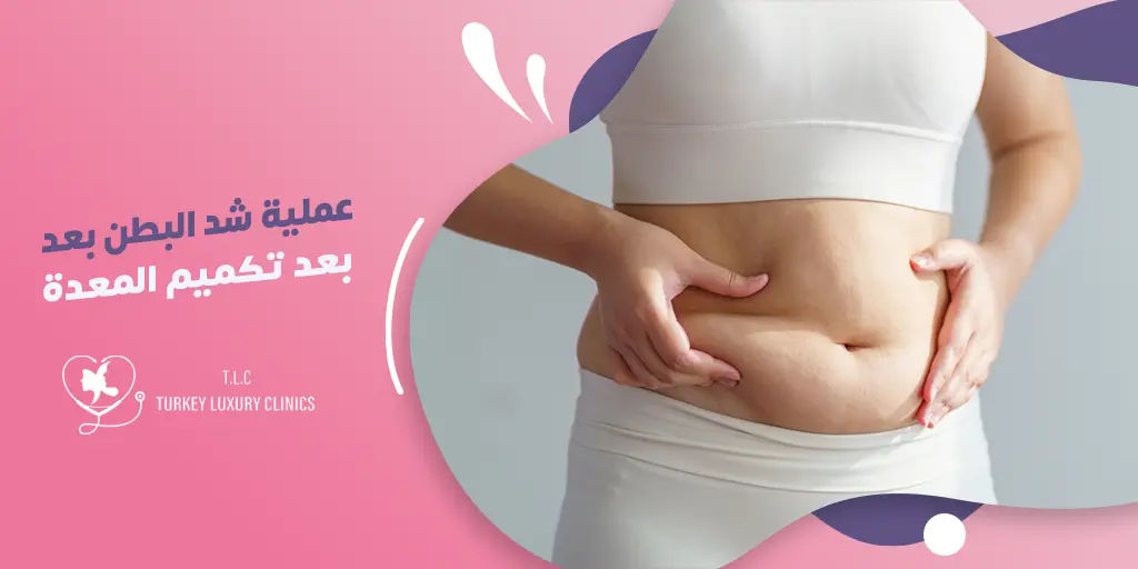 عملية شد البطن بعد تكميم المعدة