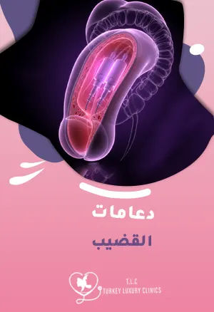 دعامة القضيب: ما هي، ومتى يُنصح بها طبيًا؟