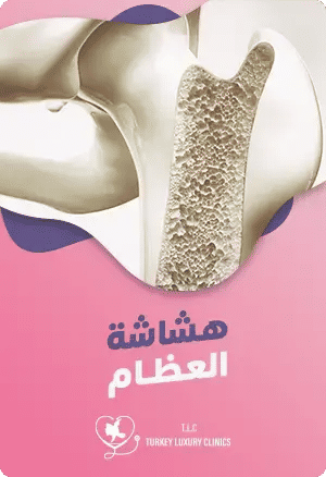 هشاشة العظام: الأعراض، والأسباب، والعلاجfeatured image