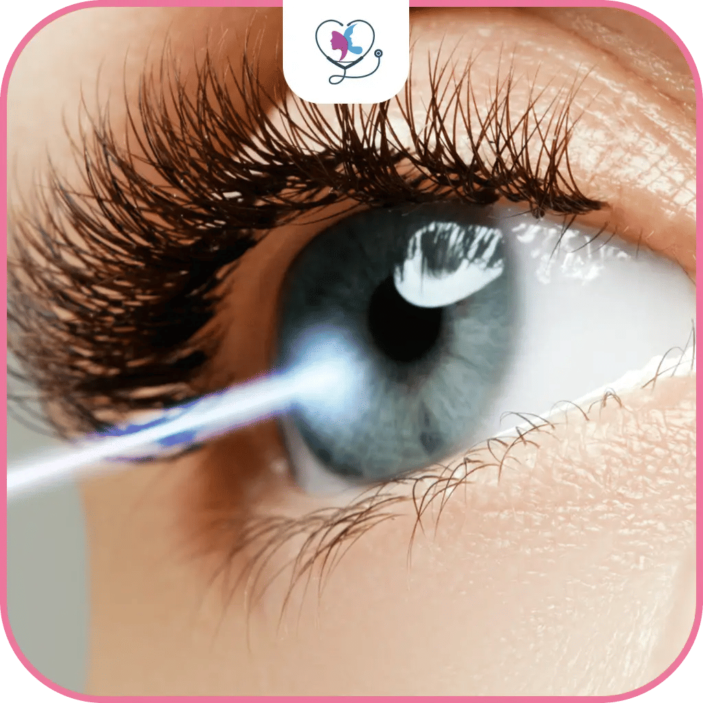 عملية الفيمتو ليزك في تركيا