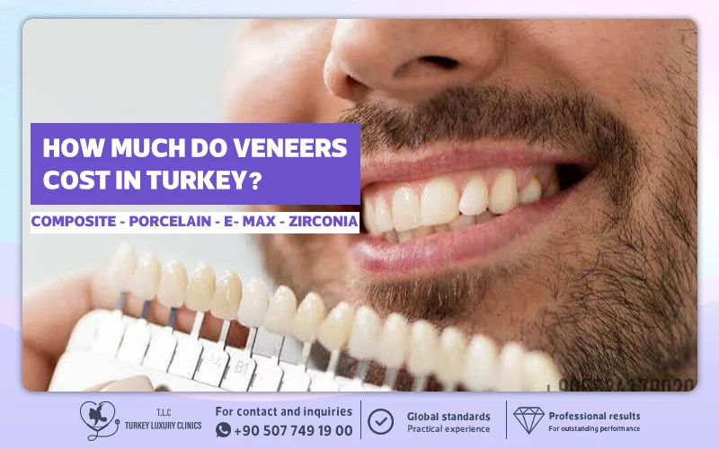 How Much Do Veneers Cost in Turkey?