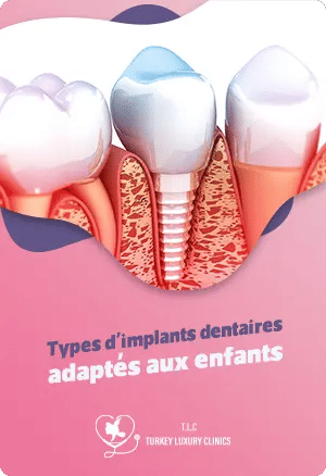 Types d'implants dentaires adaptés aux enfants