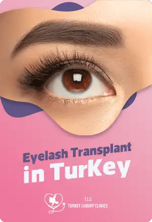 Eyelash Transplant in Turkey: Fuller, Natural-Looking Lashes