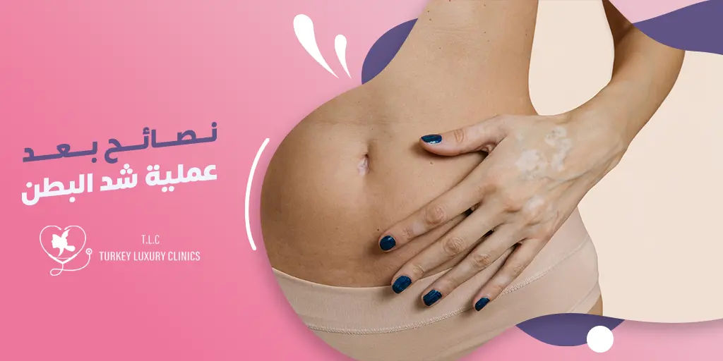 نصائح بعد عملية شد البطن
