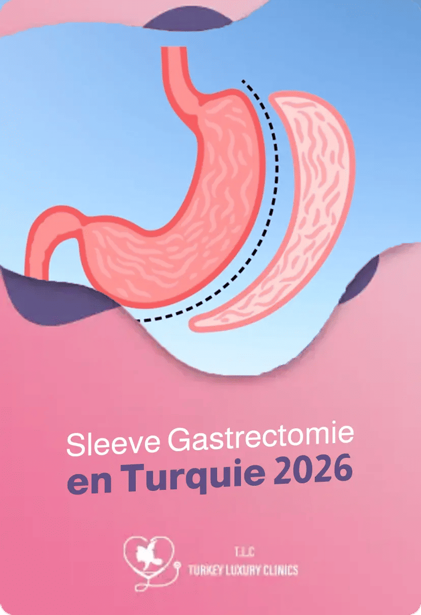 Sleeve Gastrectomie en Turquie 2026 : Prix et Avantagesfeatured image