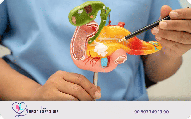 علاج سرطان البنكرياس في تركيا لاكشري كلينك