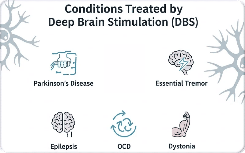 Conditions Treated by Deep Brain Stimulation Surgery