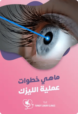 ماهي خطوات عملية الليزك؟featured image