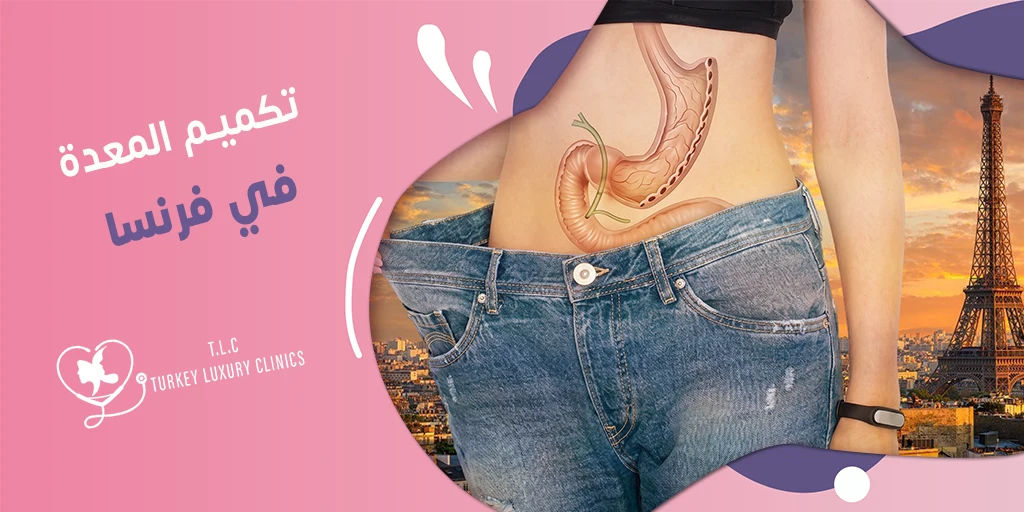 تكميم المعدة في فرنسا: التكلفة ومقارنة شاملة مع تركيا