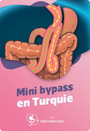 Mini bypass en Turquiefeatured image