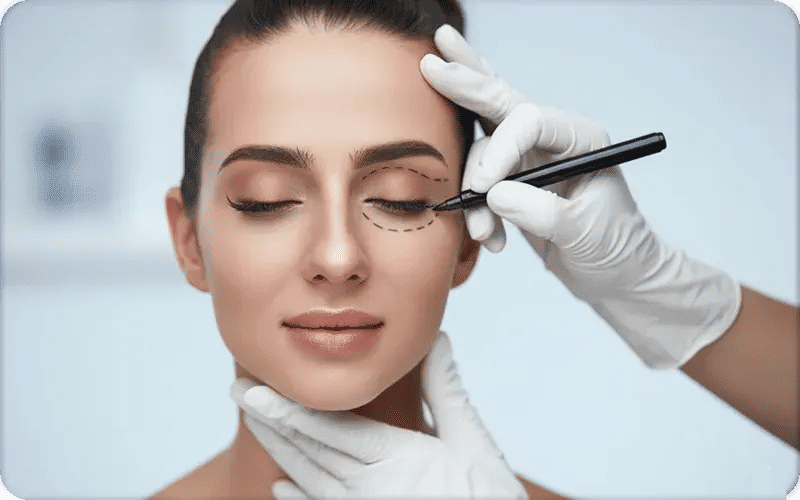 كيف تتم عملية شد الجفون؟ يوم العملية