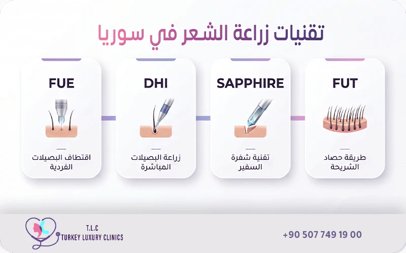 تقنيات زراعة الشعر في سوريا