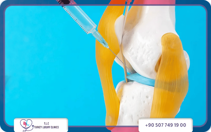 أنواع وأسعار حقن الركبة في تركيا؟ 