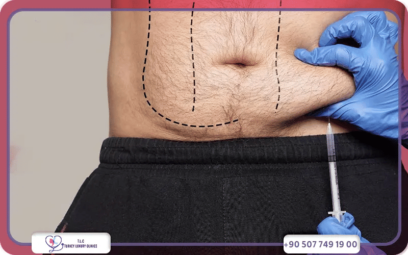 Cost of fat dissolving injections in Large Body Areas (Abdomen, Thighs, Buttocks)