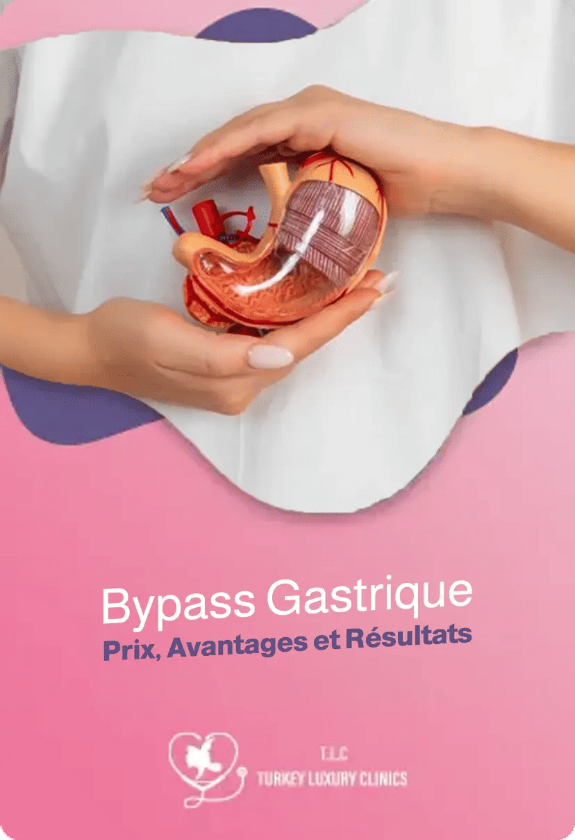 Bypass Gastrique – Prix, Avantages et Résultats