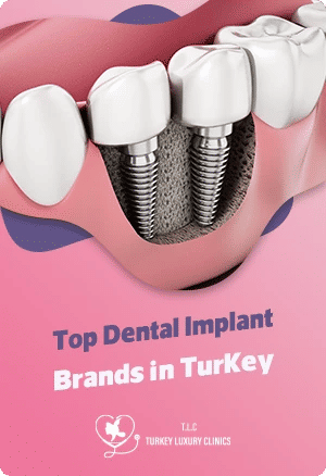 Top Dental Implant Brands in Turkey: Choosing Quality & Reliability