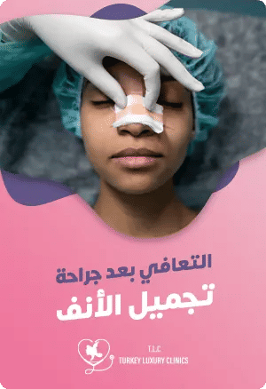 التعافي بعد عملية تجميل الأنف: كيف تكون حياتك بعد الجراحةfeatured image
