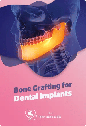 Bone Grafting for Dental Implants: Building a Strong Foundation for Success