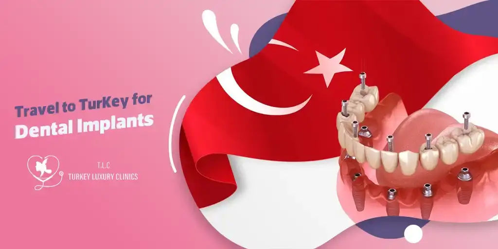 Viaja a Turquía para Implantes Dentales: Todo lo que Necesitas Saber