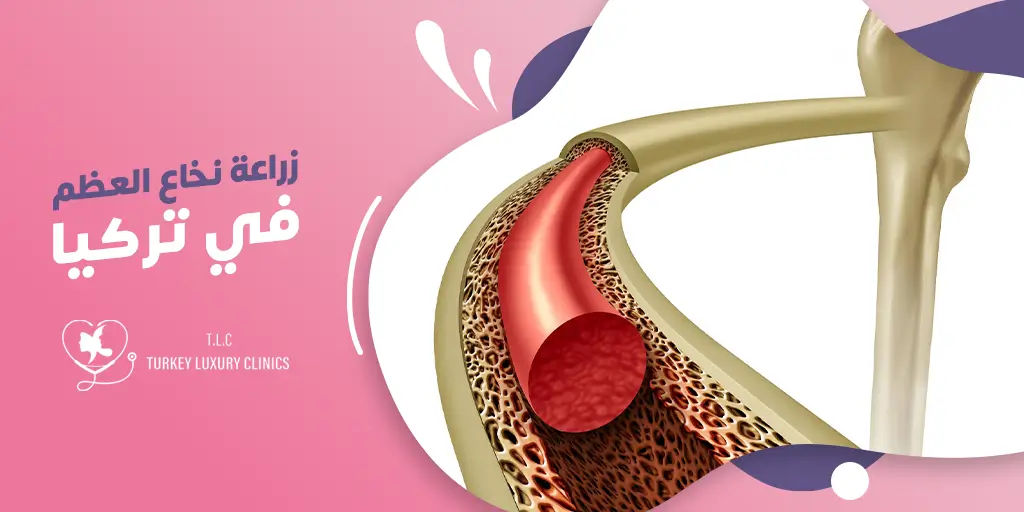 زراعة نخاع العظم في تركيا: دليك الشامل