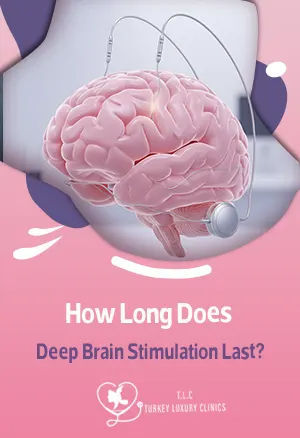 Как долго длится эффект глубокой стимуляции мозга?