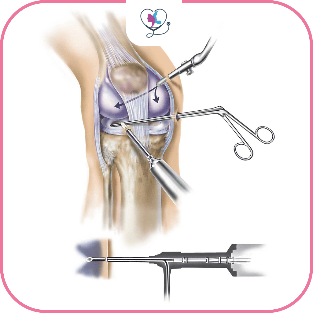 6. العلاج بالحقن Injections
