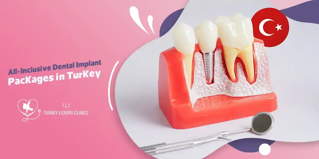 All-Inclusive Dental Implant Packages in Turkey: Travel & Smile