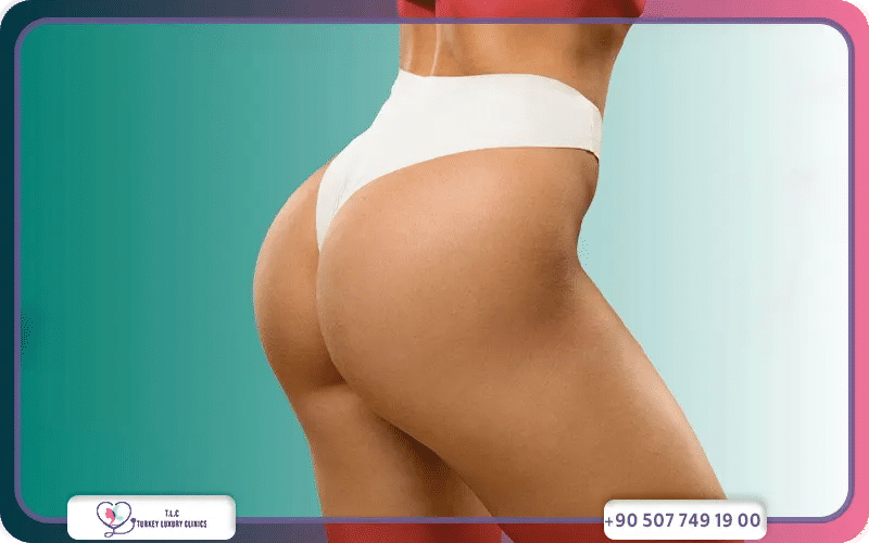 العوامل المؤثرة على تكلفة فيلر المؤخرة