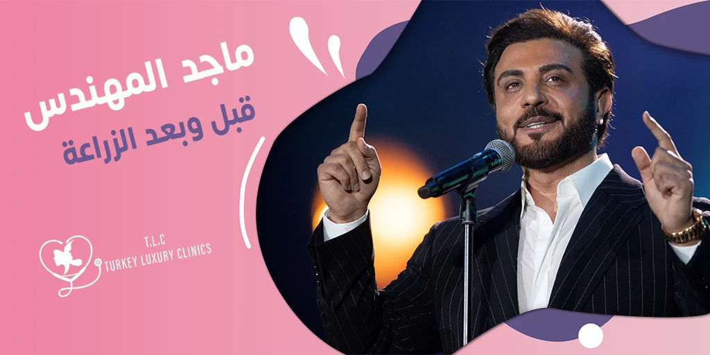 ماجد المهندس قبل وبعد الزراعة: هل تزرع شعراً أم لا؟