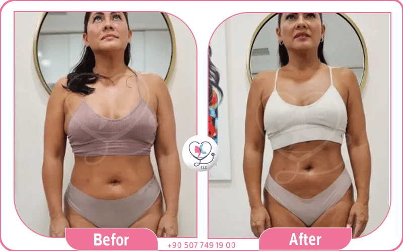 أضرار وعيوب تجاربكم مع ابر التنحيف اوزمبك 