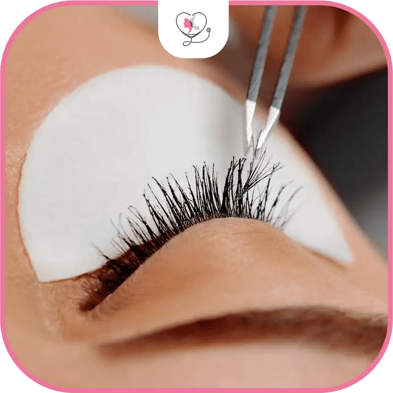 During Eyelash Transplant Surgery