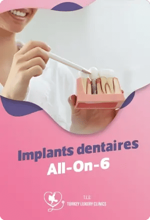Implant dentaire All-On-6 en Turquie