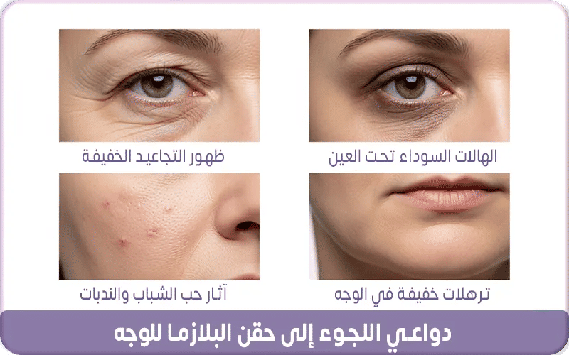 دواعي اللجوء إلى حقن البلازما للوجه