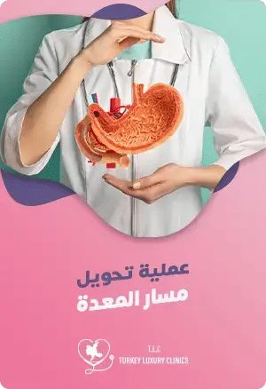 عملية تحويل مسار المعدة في تركياfeatured image