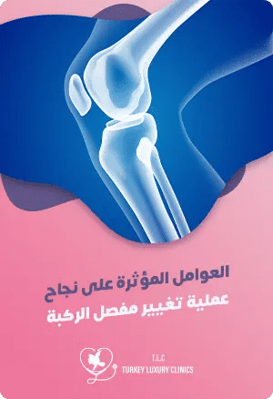 نسبة نجاح عملية تغيير مفصل الركبةfeatured image