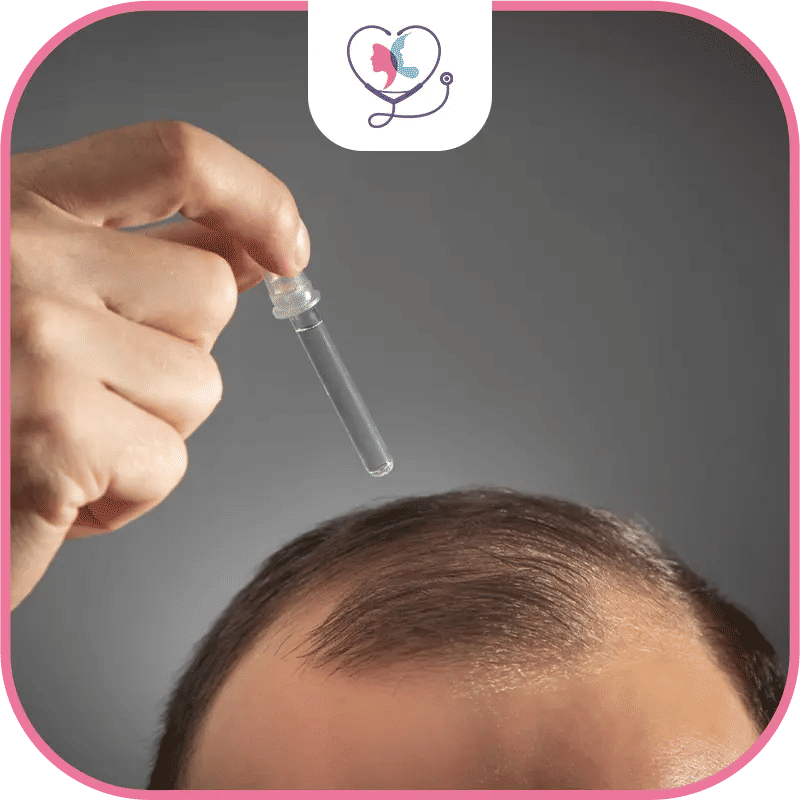 What Medications Do I Need to Take After a Hair Transplant?