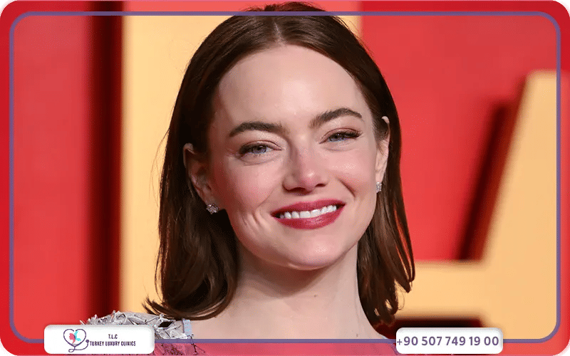 Emma Stone Plastic Surgery 2016