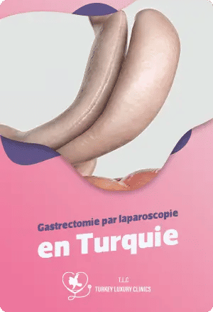 Gastrectomie par laparoscopie en Turquie : Solution mini-invasive et abordablefeatured image