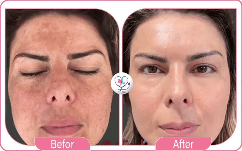 فوائد بيبي فيس للوجه